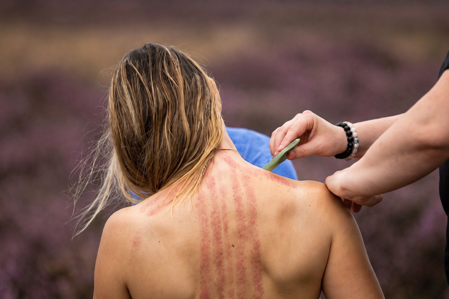 Guasha-behandeling op de rug van een mens